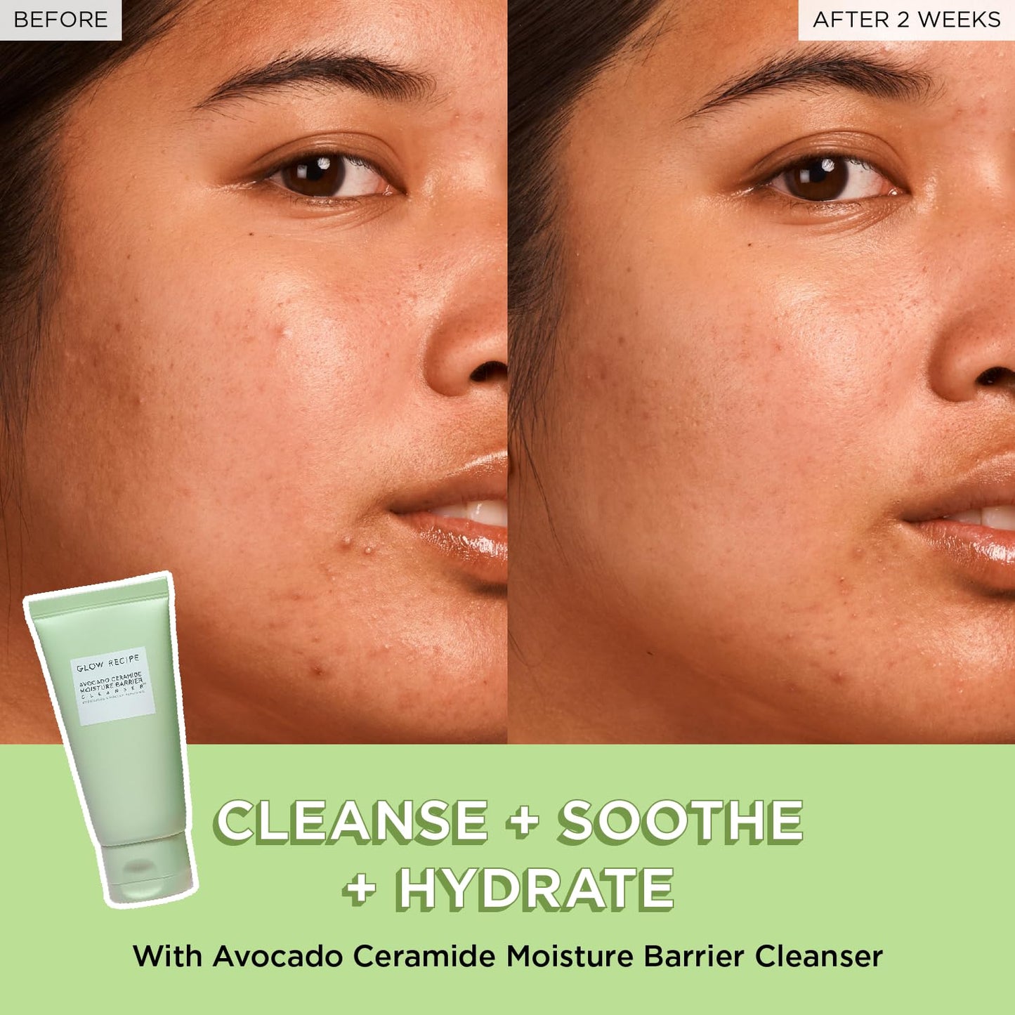 Glow Recipe Fruit Babies Skincare Kit