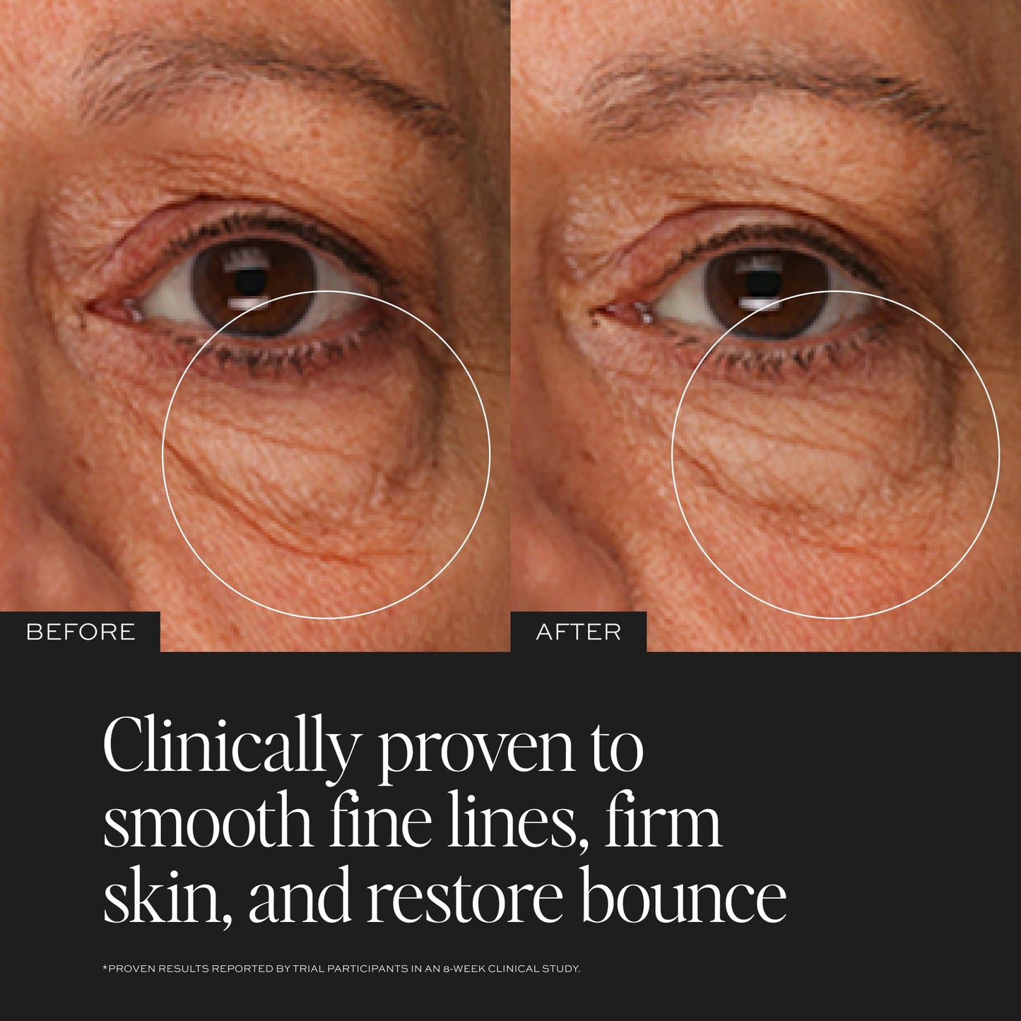 DIME Beauty TBT Eye Cream 0.5 oz (15 ml) - Smooth Fine Lines, Firm Skin, Restore Bounce, Long Lasting Hydration with Bakuchiol