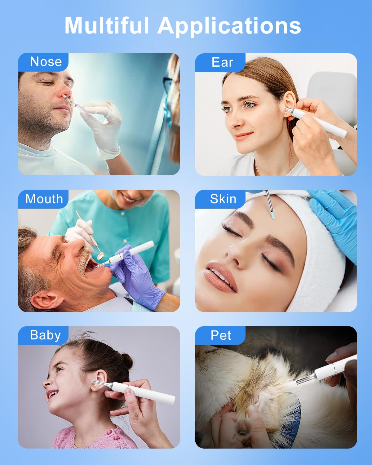 MEKK Smart Ear Wax Removal Kit S5-10MP HD Visual Ear Cleaner with Precision Tweezers, 12 Tools & Travel Case - Wireless Otoscope for iOS/Android (White-S5)