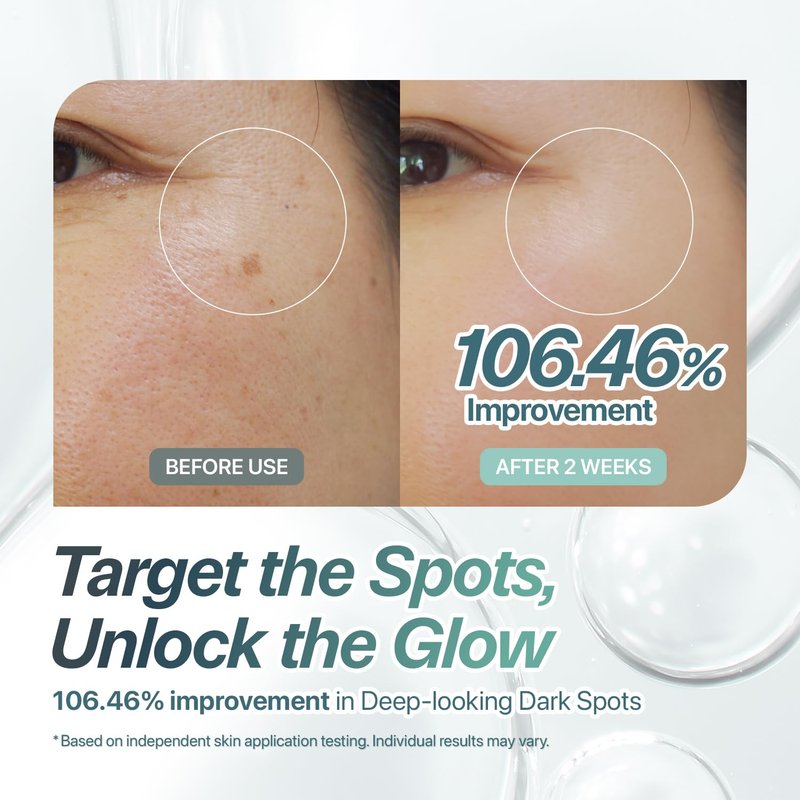 Niacinamide Serum for Dark Spots & Uneven Skin Tone – Pure Niacinamide + White Garcinia & Arbutin – Brightening Korean Skincare Face Serum for Dark Spot Corrector, Dullness & Texture (1.01 fl oz)