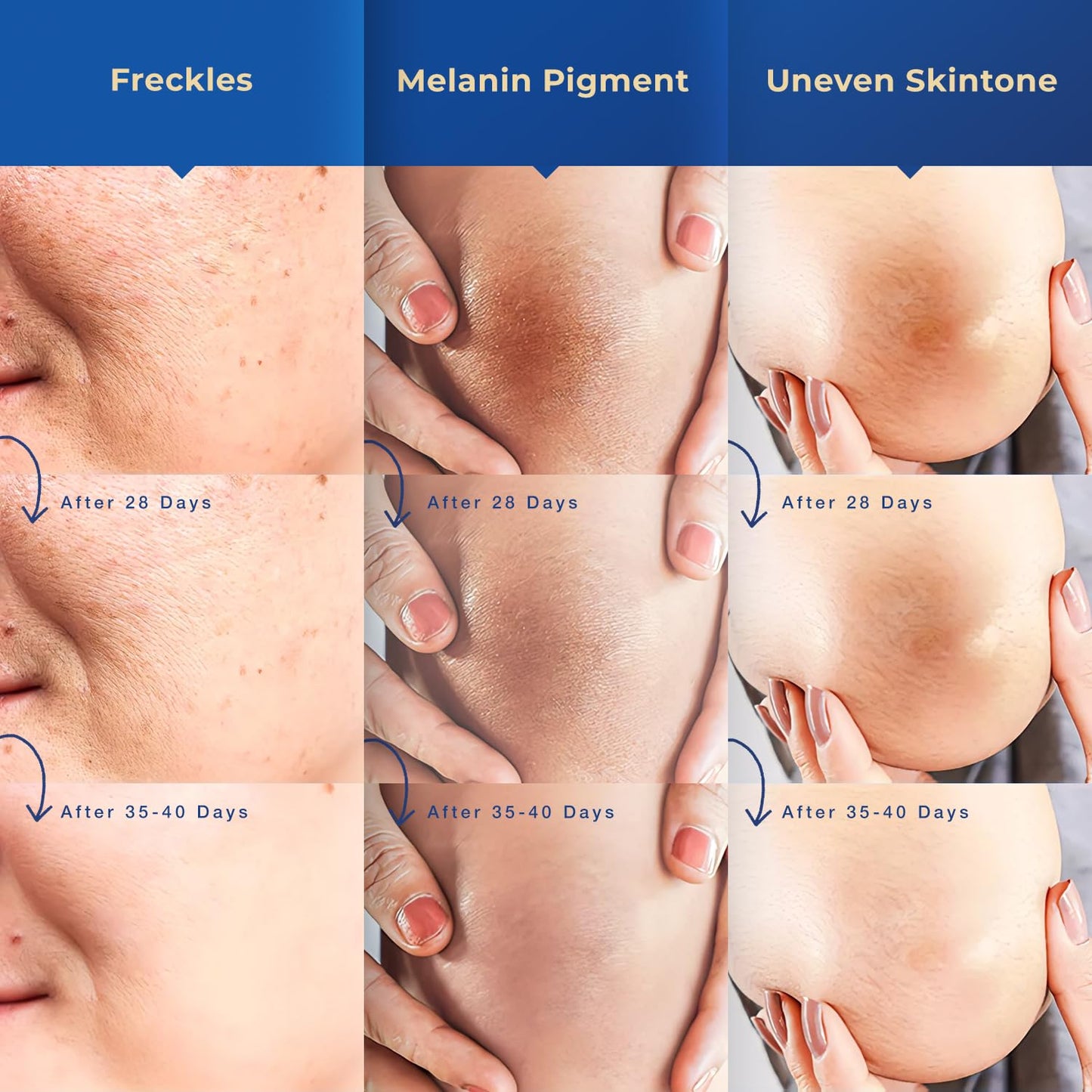 Dark Spot Remover for Face and Body: Corrector for Age, Sun, Freckle, Melasma, Brown Spots - Niacinamide, Vitamin C Formula - Use on Face, Hands, Underarms, Legs - 2 Oz