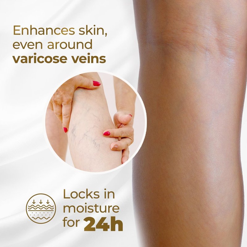 Goicoechea Arnica & Chamomile Body Lotion | Soothes Tired Legs; Hydrates & Refreshes Skin; Non-Greasy Daily Formula; Varicose Veins Cream; Improves Appearance of Varicose Veins, 13.5 Oz, 3-Pack