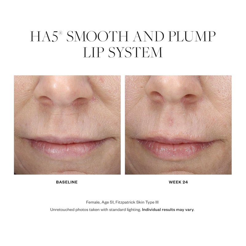 SkinMedica HA5 Lip Plumper - Hydrating & Volumizing Lip Treatment for Fuller, Smoother Lips | 0.05 Oz