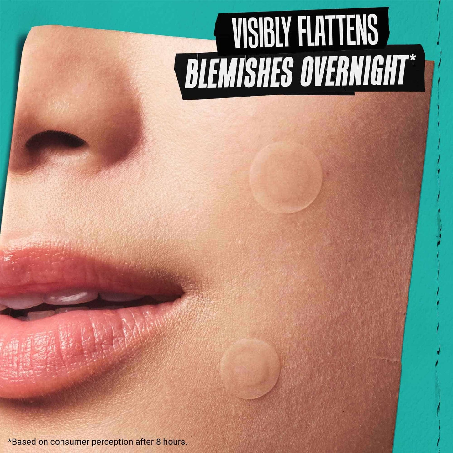 Kiehl's Overnight Pimple Patches - Truly Targeted Invisible Hydrocolloid Blemish Patch, Spot Stickers Absorb Oil and Gunk, Acne Treatment for Shrinking Whiteheads, Blackheads, and Zits (22 Count)