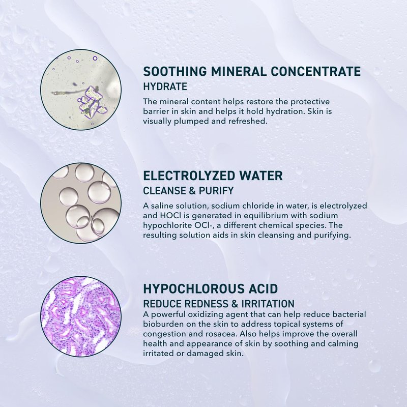 Prequel Skin Universal Skin Solution Hypochlorous Acid Spray for Face and Body. Fine Mist HOCL Facial Cleanser and Dermal Spray with Minerals & Electrolyzed Water - pH-Stabilized Care. 4oz