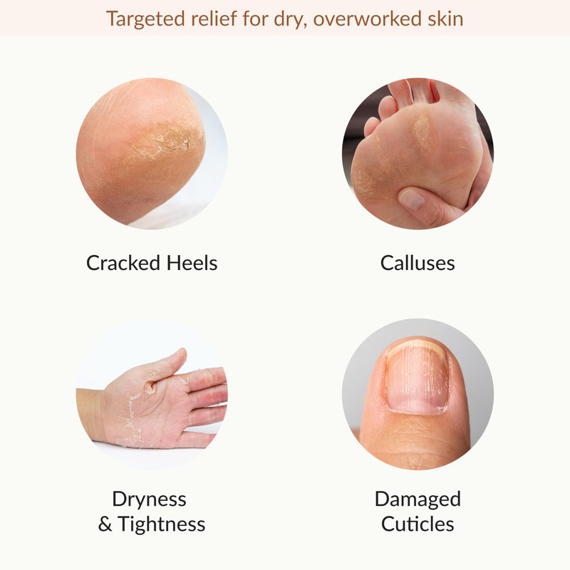 Epielle Hydrating & Moisturizing Hand & Foot Masks, Relieve and Soften Dry, Rough Skin, Self Care Gifts for Women, Spa Kit, 6 Moisturizing Gloves & 6 Moisturizing Socks