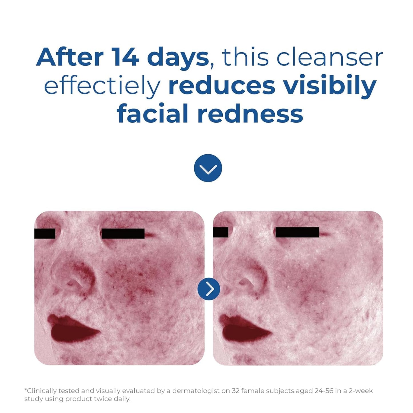 EltaMD Skin Recovery Amino Acid Foaming Facial Cleanser - Gentle Face Wash for Sensitive & Post-Procedure Skin