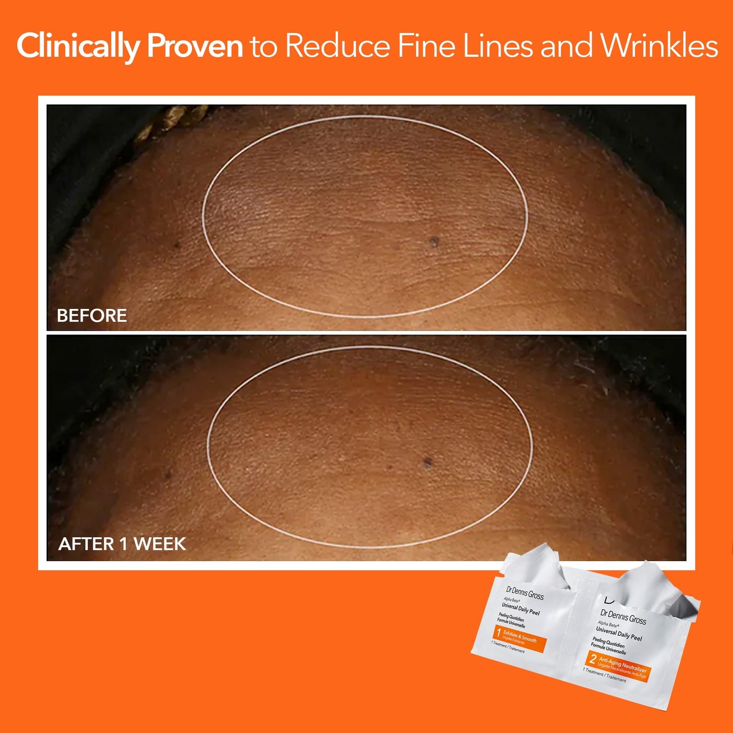 Dr Dennis Gross Alpha Beta Universal Daily Peel: for Uneven Tone or Texture and Fine Lines or Enlarged Pores, (30 Treatments)