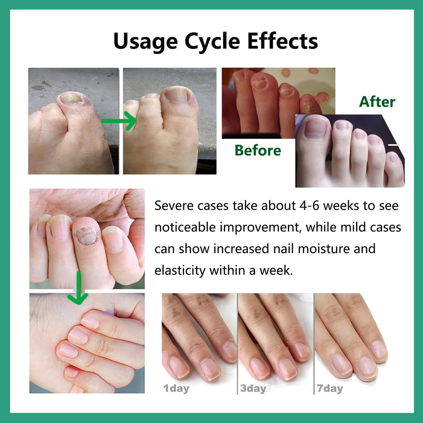 Natural Nail Care Gel, Nutraboost Strengthening Cuticle Serum for Damaged & Brittle Nails, 20ml (1 pcs) (3pcs)