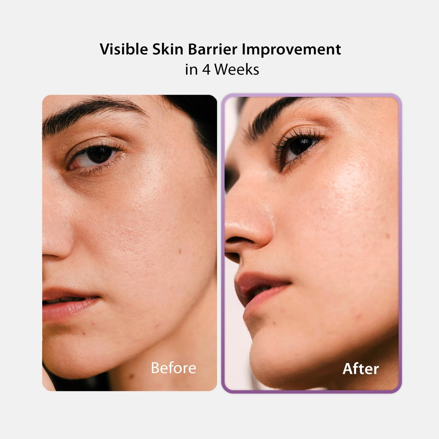 BLITHE Vital Essence 8 Beans - Korean Skin Care Elasticity & Skin Barrier, Adenosine Vitamin E - Fermented Olive & Argan Oil (4.1 fl oz)