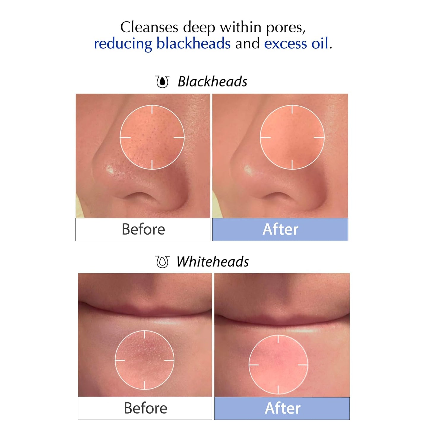 MSM Sulfur Deep Pore Cleanser | Low pH Face Wash for Sensitive Skin - Pore Reset Formula