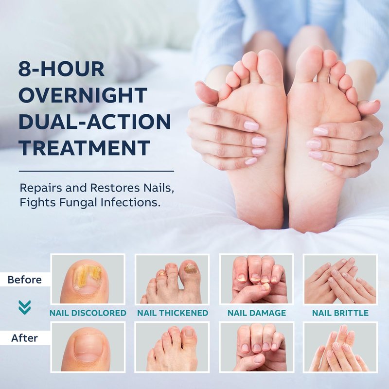 Toenail Fungus Treatment Extra Strength Kit: Nail Repair Liquid Solution and Patches - Nighttime Nail Patches Renewal - Fast Acting Drops with Undecylenic Acid, Natural Oil for Toe Finger Nails