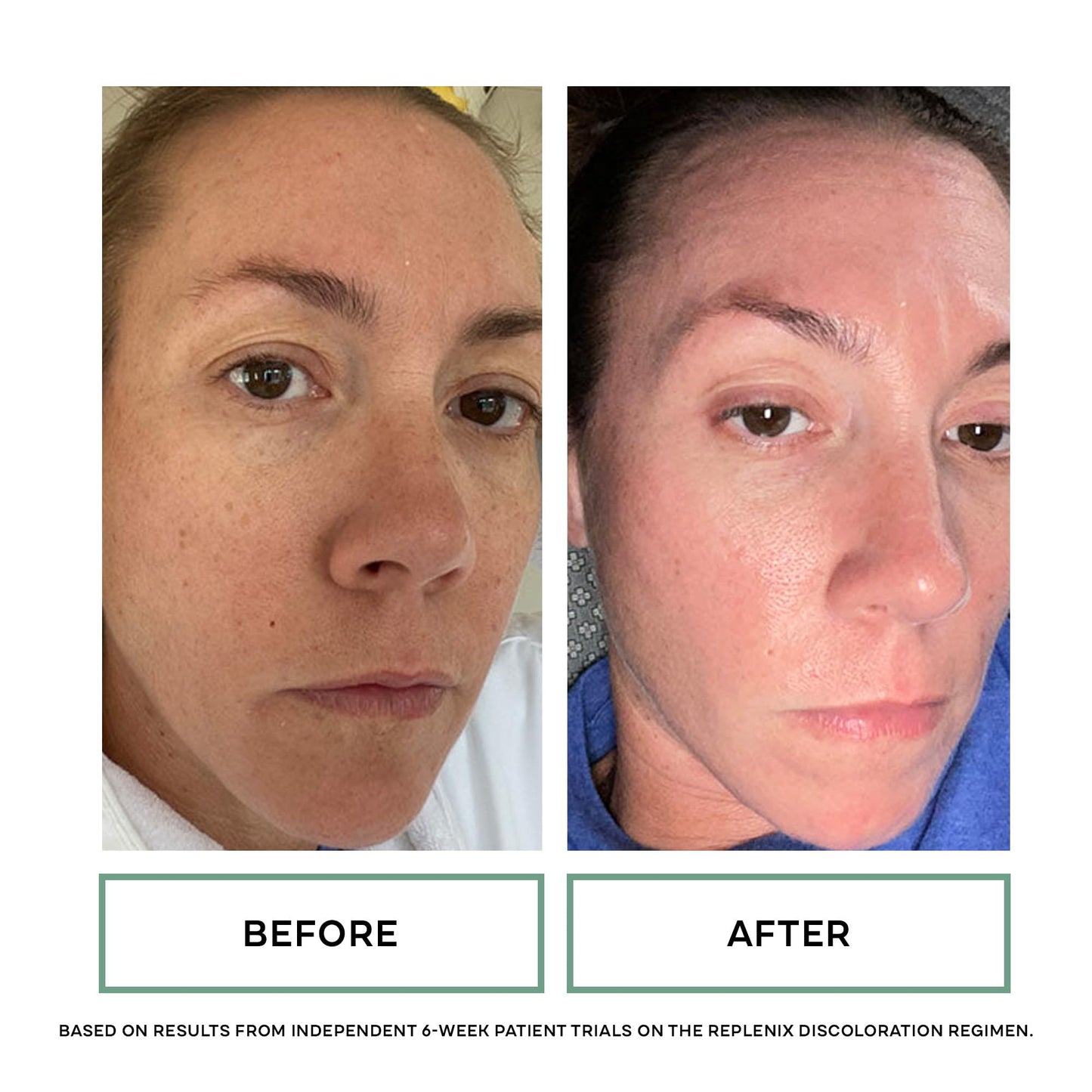 Replenix - Glycolix Elite Glycolic Acid Resurfacing Peel Pads - Medical Grade Brightening and Exfoliating Treatment, Travel Friendly Pads, 60 ct.