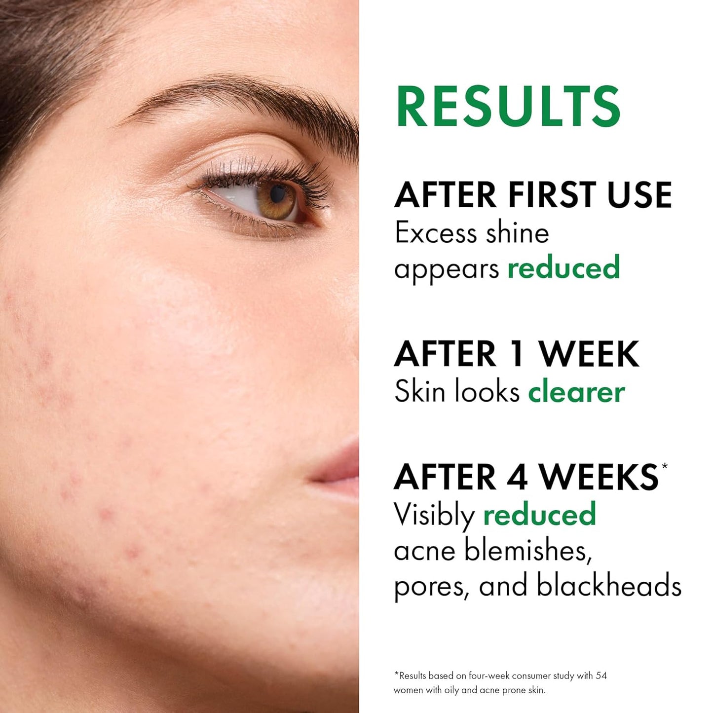 VICHY Normaderm Daily Acne Face Wash - Salicylic Acid Cleanser for Oily Skin | Clears Clogged Pores & Blackheads
