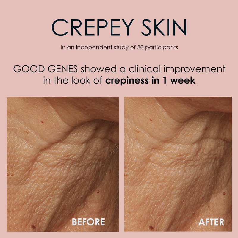 Sunday Riley Good Genes All-in-One Lactic Acid Treatment Face Serum