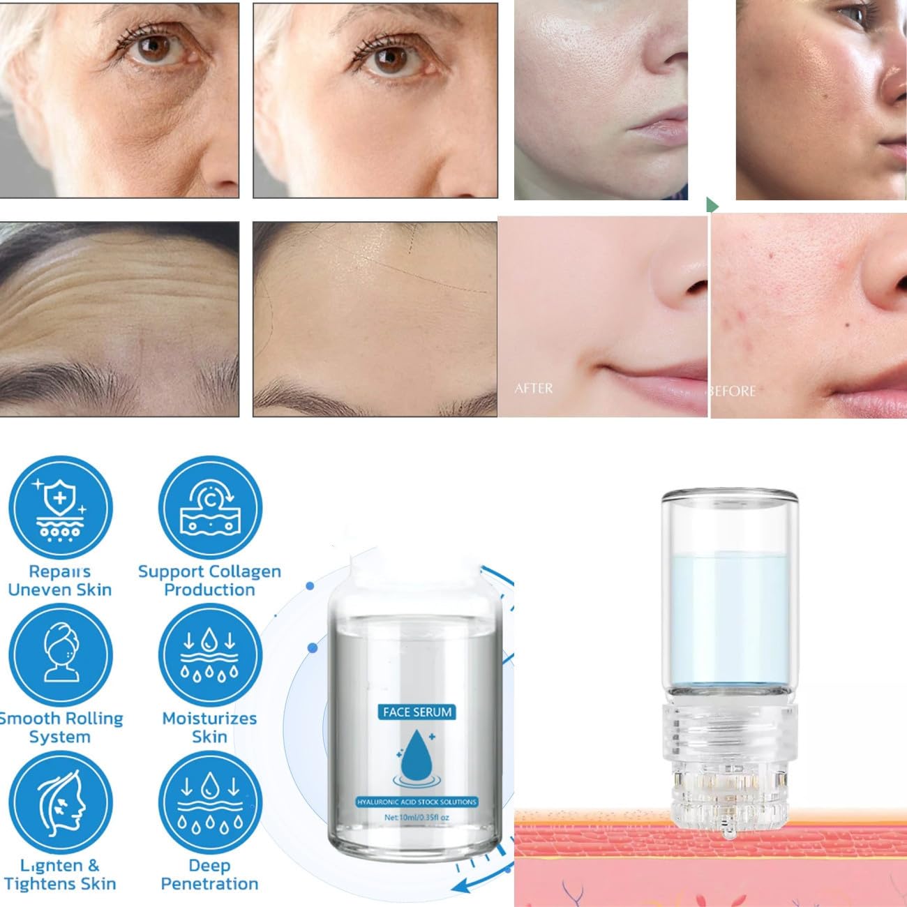 Micro Infusion System for Face,Micro Facial Serum For Many Skin Types 7pcs