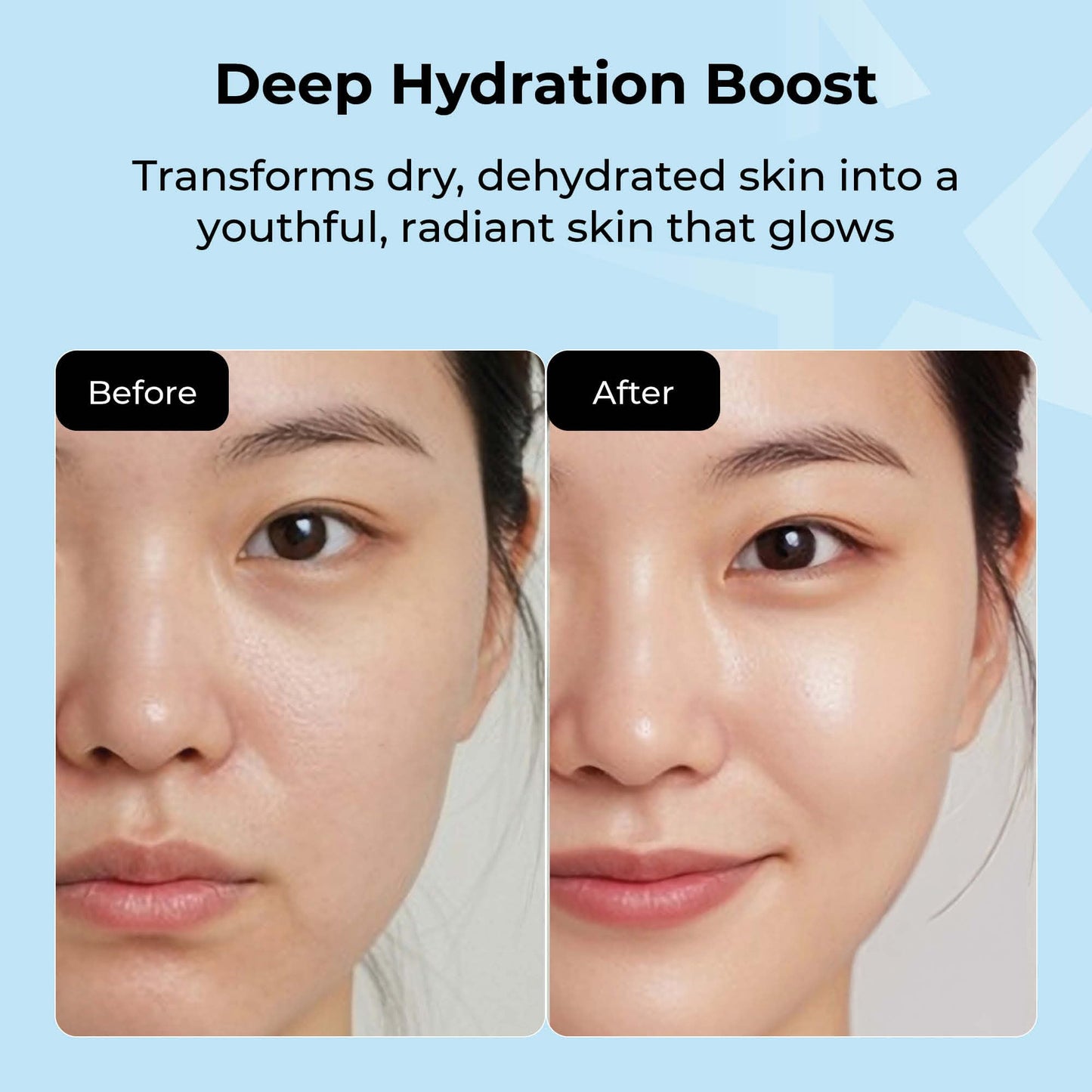 STARSKIN Hydrating Face Mask, Bio-Cellulose & Probiotics, 3+1 Pack, Deep Hydration & Nourishing, Revitalizing & Anti-Aging, Glass Skin, Cooling, Moisturizing, Korean Face Mask, Red Carpet Ready