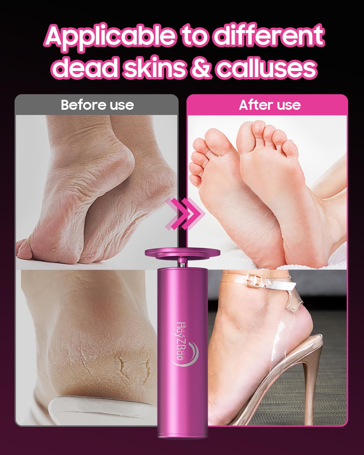 HayZBao Electric Foot Callus Remover with 60 Pcs Sandpaper Discs - Electric Callus Remover for Feet,Pedicure Tool for Dead Skin (Matte Purple)