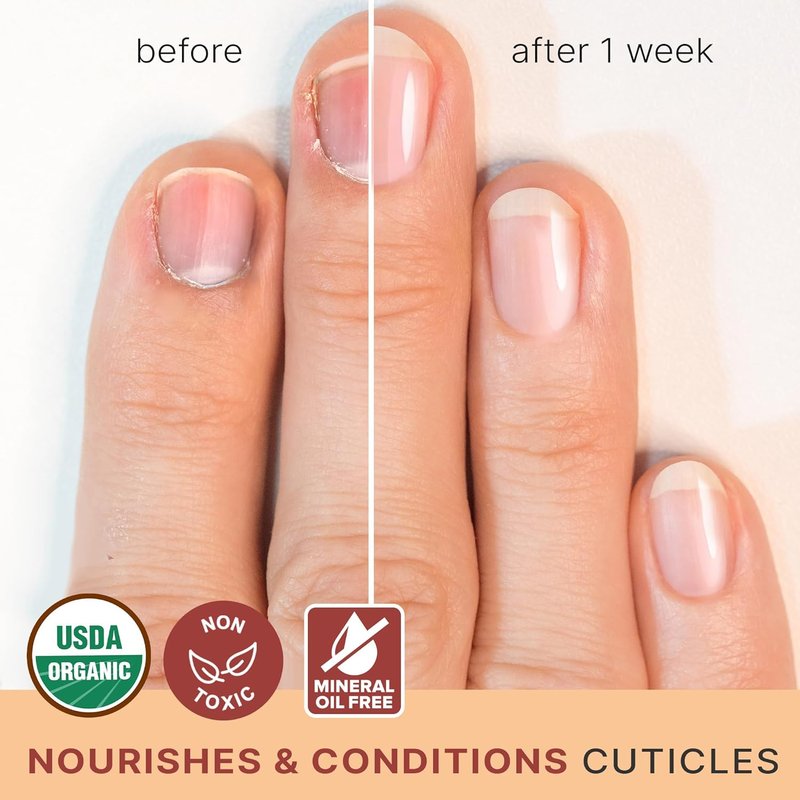Organic Nail and Cuticle Oil - Jojoba & Vitamin E for Growth, Strength | Natural Nail Care & Repair