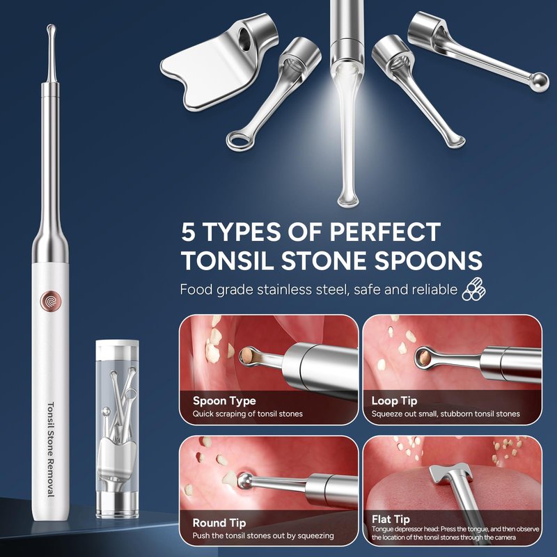 Tonsil Stone Remover with Camera - Upgraded Visual Tonsil Stone Removal Kit with 6 LED Light -Tonsil Stone Remover Tool with 1080P Camera, 5 Stainless Steel Heads, Irrigator, for iOS & Android(White)