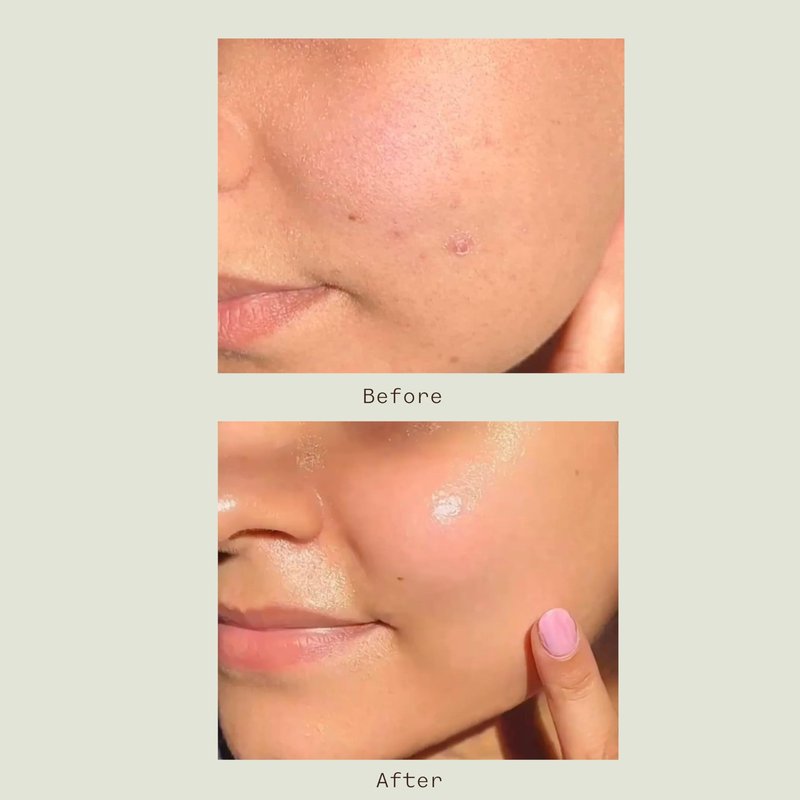 Matter of Monday Face Wash – Gentle Exfoliating Cleanser for Sensitive Skin | Refines Pores, Removes Makeup, Softens Skin, Fruit Enzymes, Barrier Protection, Non-Stripping, 3.4 fl oz