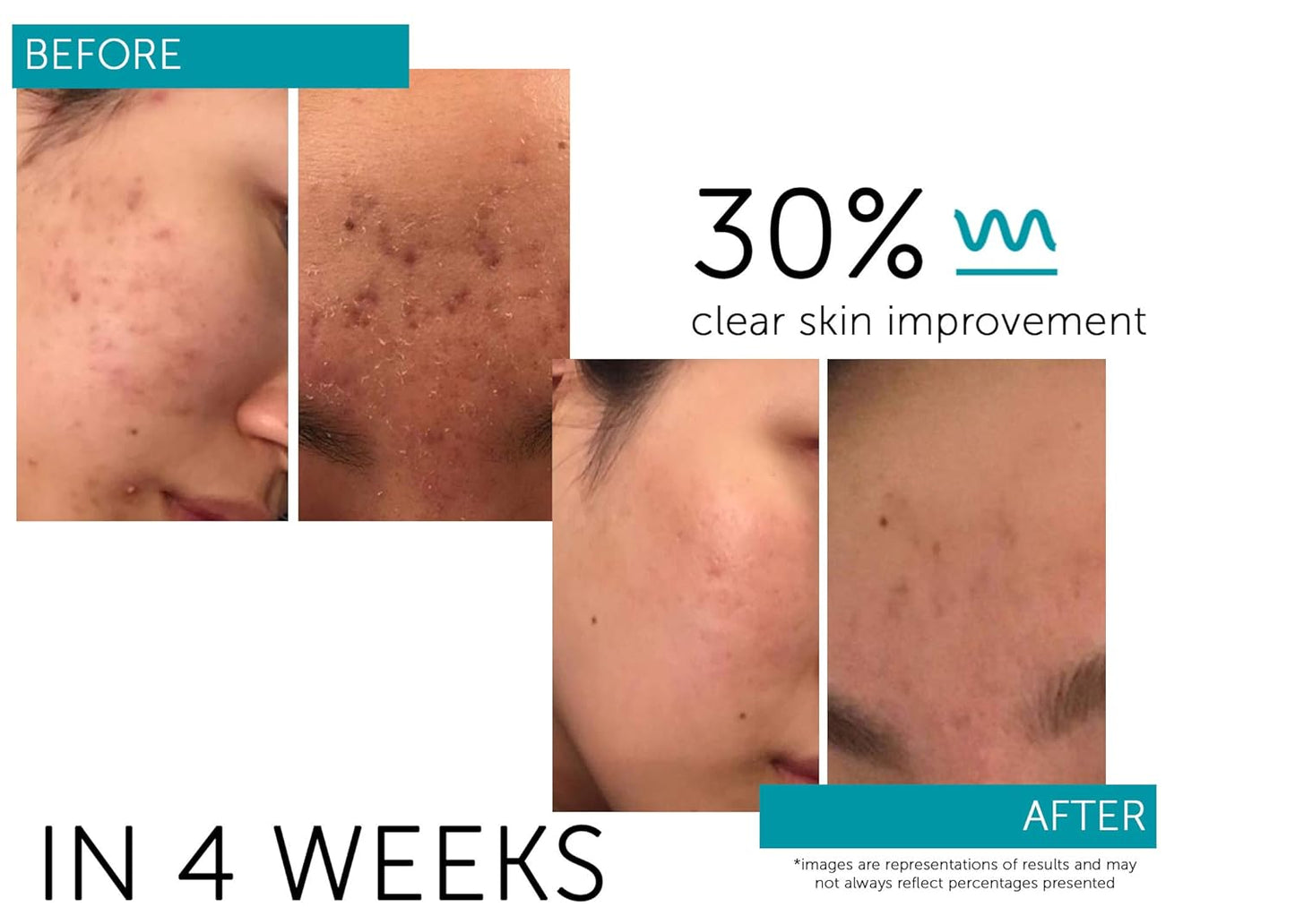 Factorfive Regenerative Serum - Stem Cell Growth Factors for Skin Tightening & Wrinkle Reduction | 1 fl oz/30ml