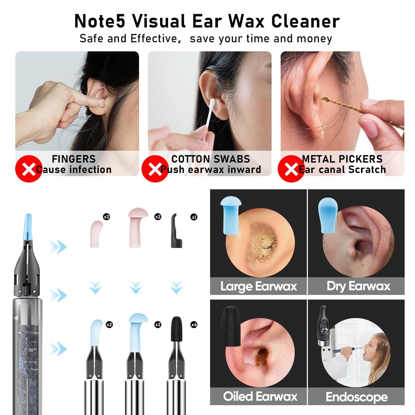 KWYBOW Note5 Ear Wax Tweezers with Camera, 10MP Ear Cleaner Camera Otoscope with Light,Real-time Remote Video with Ear Pick & Tweezers,12 Pcs Ear Scoops for Whole Family