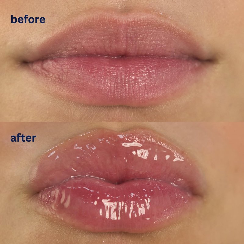 Endless Skin - Daydream - Natural Vanilla Flavor Lip Balm with Jojoba Oil, Hyaluronic Acid and Squalane - Ultra Glossy Finish that Nourishes and Hydrates Your Lips - Vegan and Paraben Free - 15ml