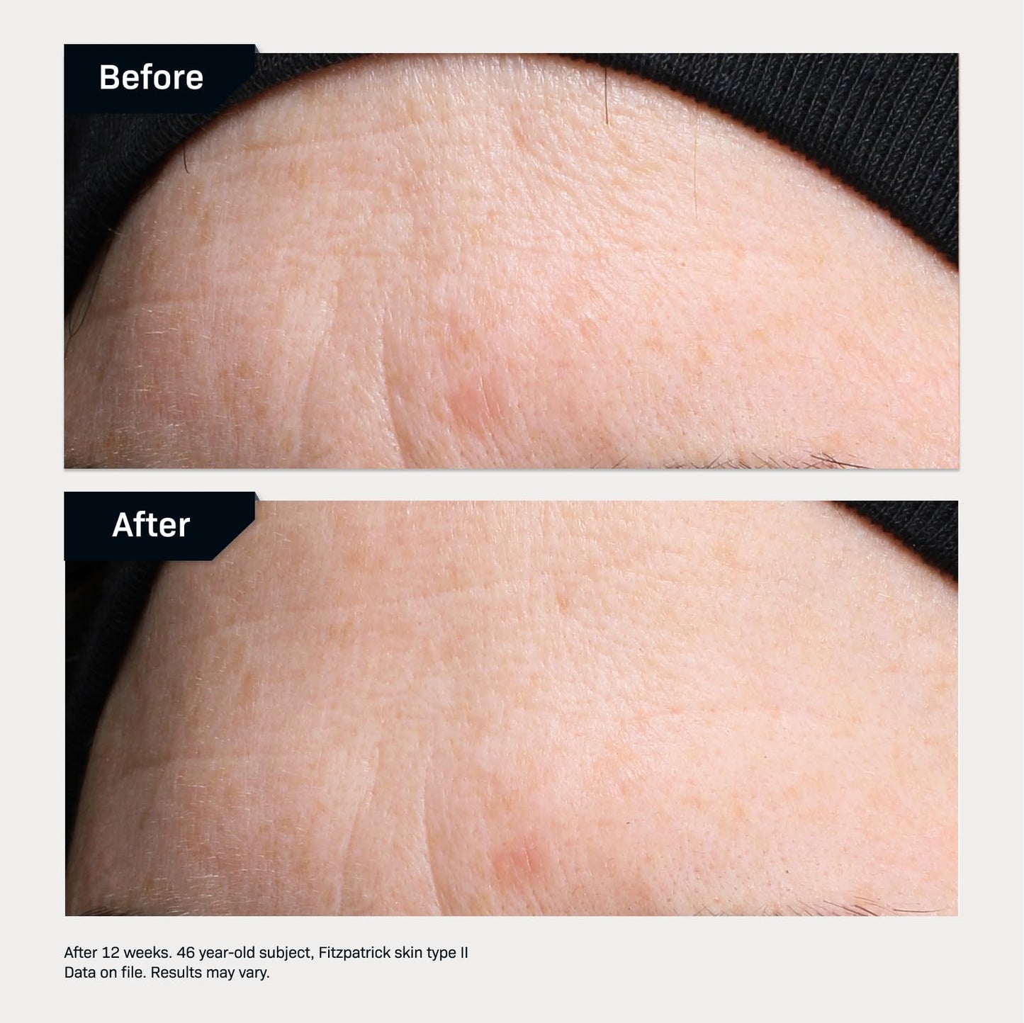 Revision Skincare Revox™ Line Relaxer Peptide Serum