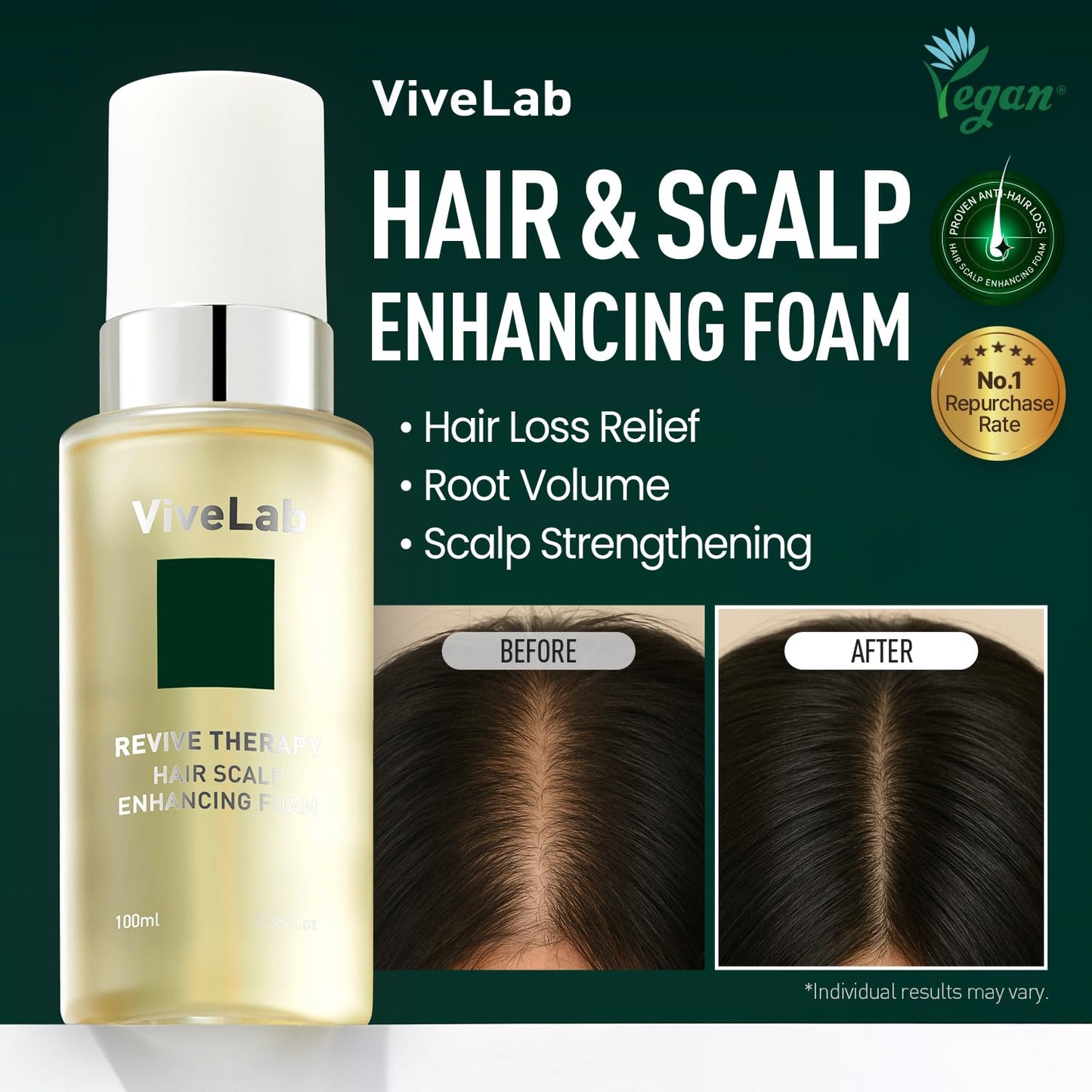 ViveLab Hair Growth Serum - Micro Foam Scalp Treatment with Biotin, Rosemary Oil & Caffeine | Vegan, Clinically Tested for Thicker Hair