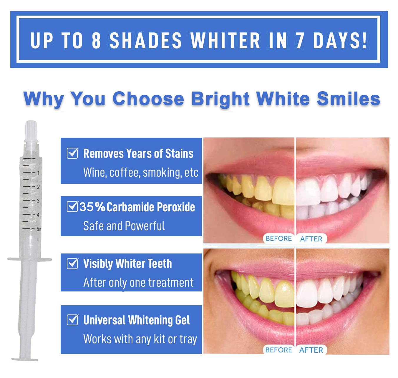 Bright White Smiles 35% Carbamide Peroxide Teeth Whitening Gel Refills, Sensitive Teeth Whitener, Works with LED Light and Trays (10 X 5 ML/CC)