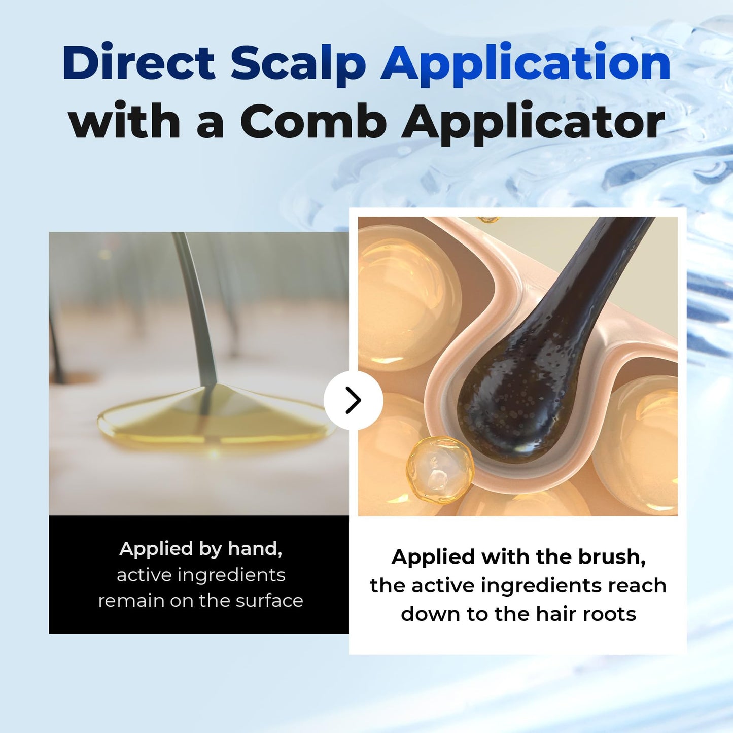 EPAIS Scalp Boosting Serum, Comb Applicator Scalp Ampoule with 38 Brush Tips, Clinically Tested Dandruff & Flake Reduction, Biome PDRN Exosome, Korean Hair Care, 5.07 fl.oz.