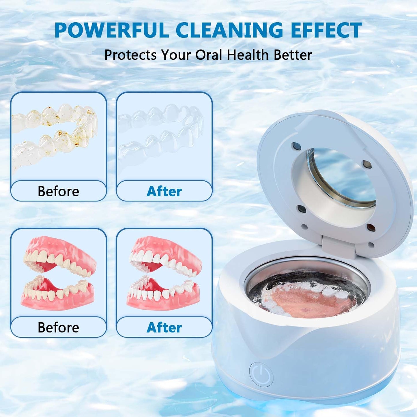 Hoffeins Ultrasonic Retainer Cleaner Machine 45kHz 200ml Portable Ultra Sonic Retainer Cleaner for Dental Retainer Mouth Guards Aligner Night Guard Braces Toothbrush Jewelry