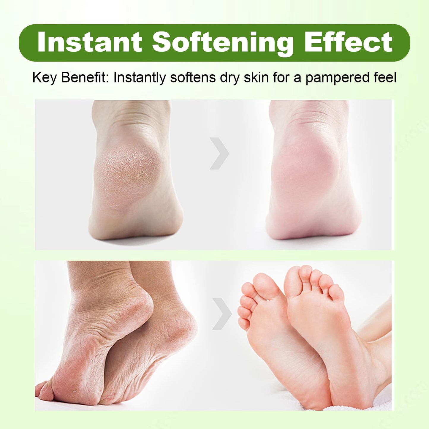 NOAGERYAS Urea Cream with 40% Urea, Tea Tree Oil, and Aloe Vera - Moisturizing Foot Cream for Soft, Smooth Skin - Ideal for Rough, Cracked, and Dry Feet