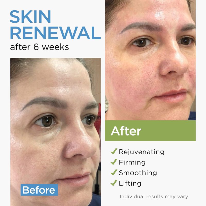 Moisturizer Collagen Anti-Aging Face Cream with Stem Cells, Retinol, Hyaluronic Acid & Niacinamide - Hydrating Day & Night Wrinkle Cream for All Skin Types - Airless Pump - Made in USA - 1.7Oz