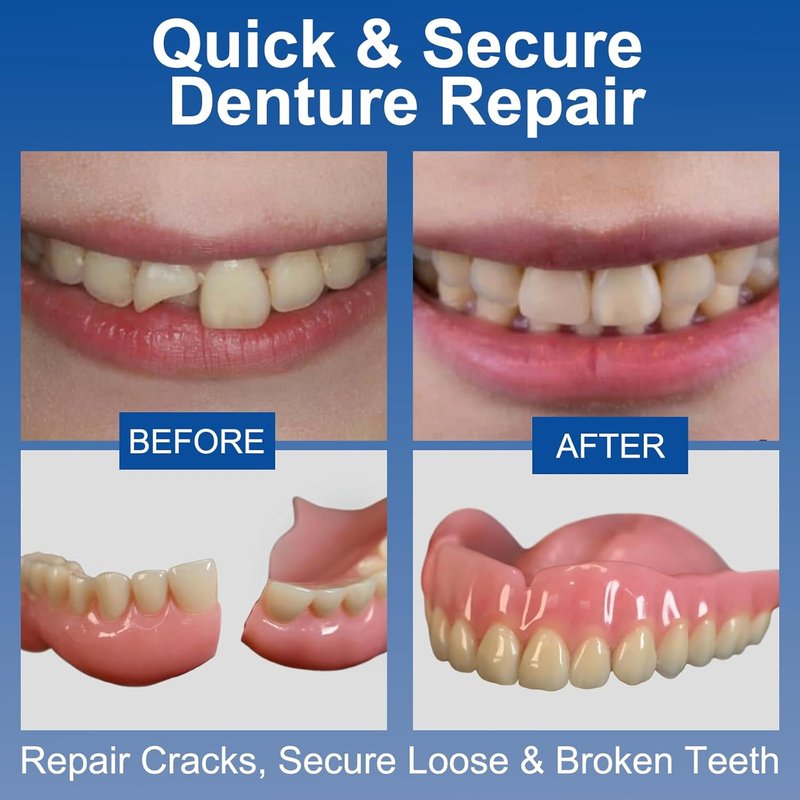 Instant Bonding Dental Glue - Super Strong Adhesive for Repairing Loose & Broken Teeth | 1 oz, Clear Color
