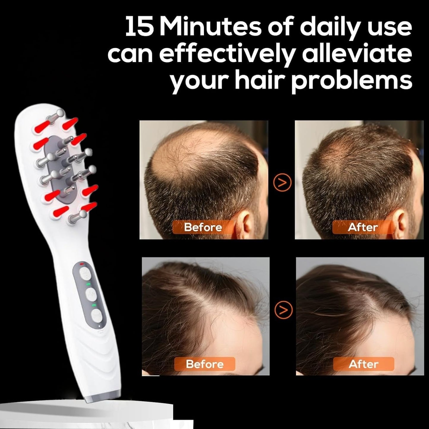 Laser Therapy Hair Growth Comb - Advanced Hair Regrowth Device for Thinning Hair
