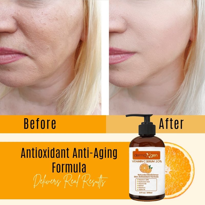 DERMAXGEN Organic 20% Vitamin C Serum for Face (08 Fl oz)