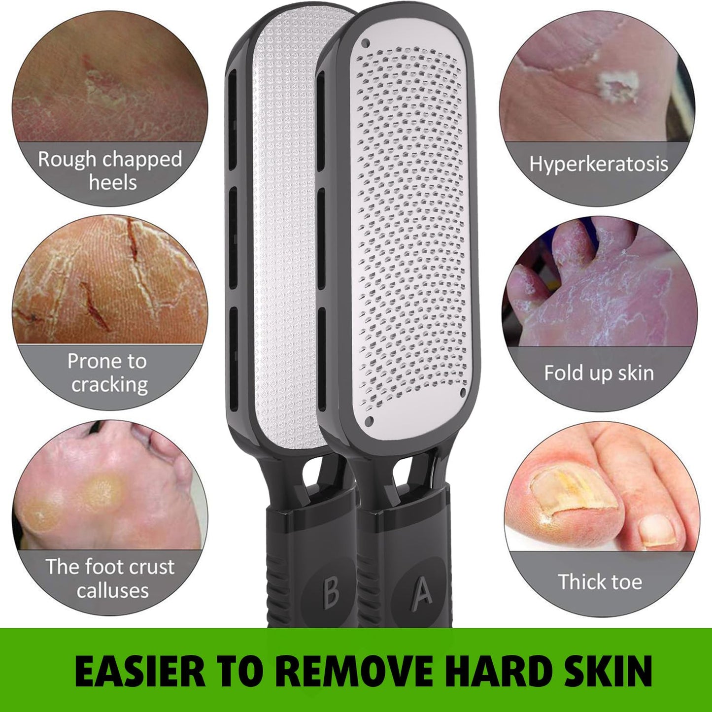 Antonki Foot File for Dead Skin, Double Sided Callus Remover for Feet, Metal Foot Scrubber for Cracked Heel, Professional Foot Scraper Rasp Pedicure Tool to Remove Hard Skin - 2 in 1 Foot File