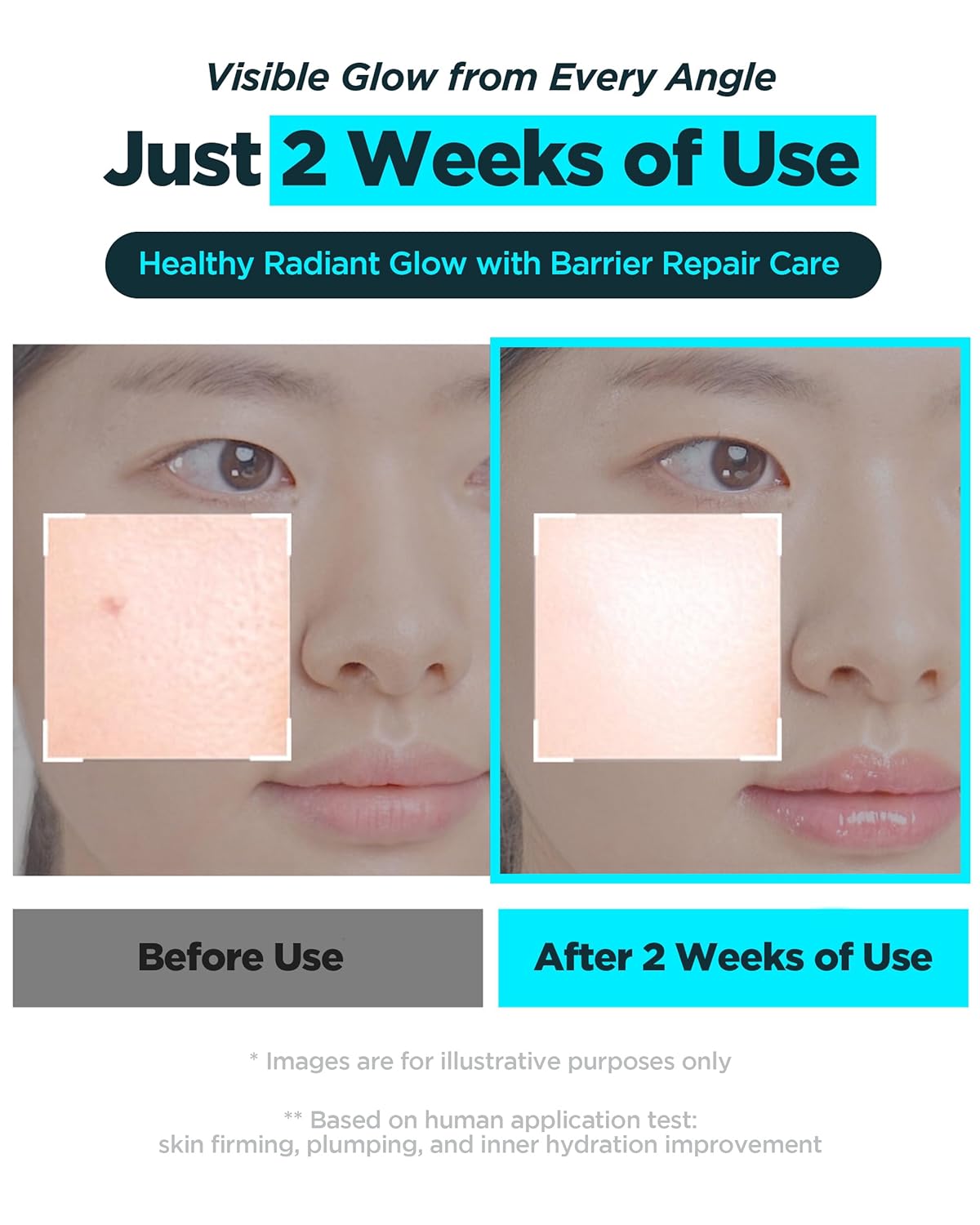 WELLAGE Korean Hyper PDRN Anti-Aging Serum - Hyaluronic Acid & Collagen for Pore Care | 1.01 fl. oz