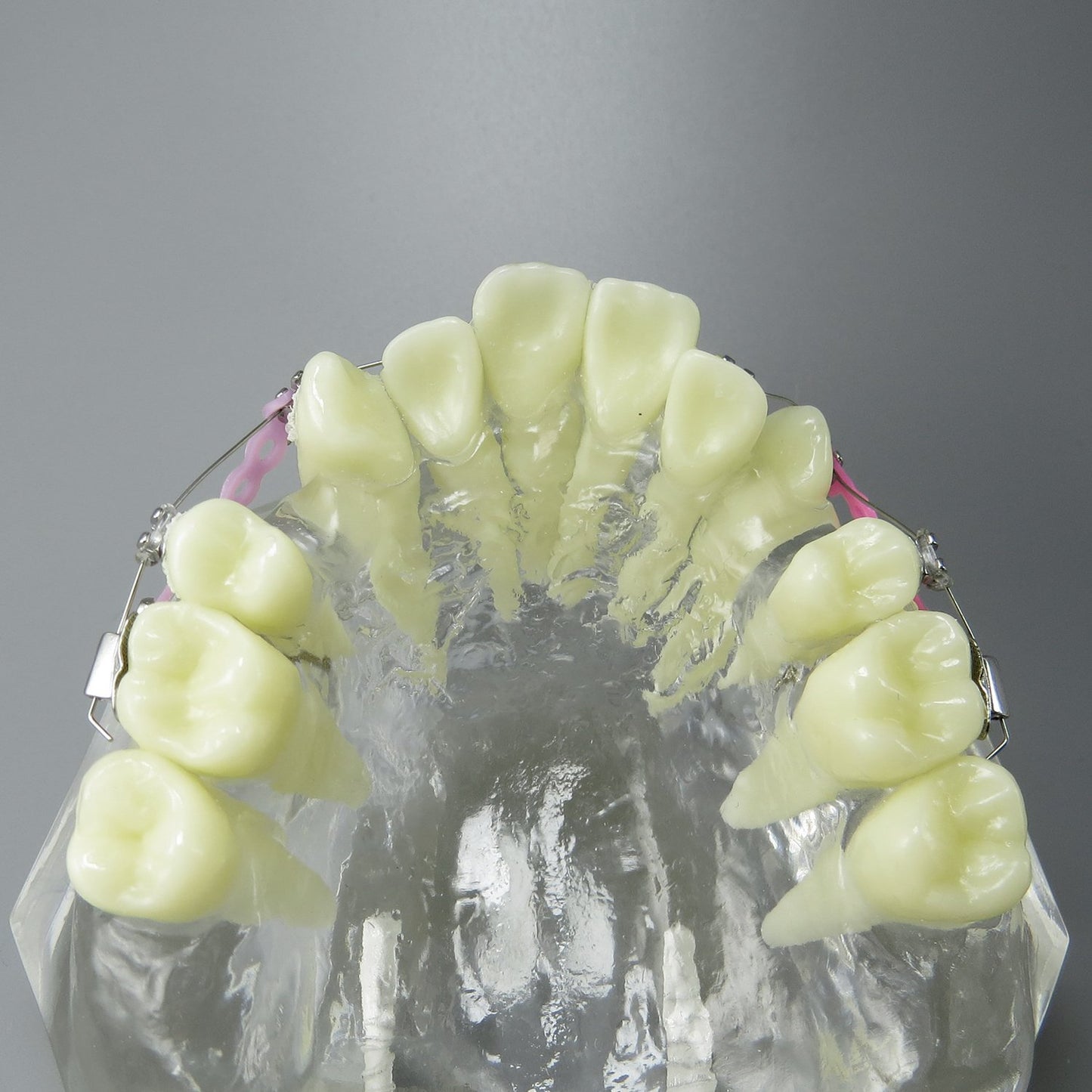 Smile1000 Dental Malocclusion Orthodontic Treatment Teeth Model with Metal Brackets Wires Colorful Ties Chains and Hoops M3005