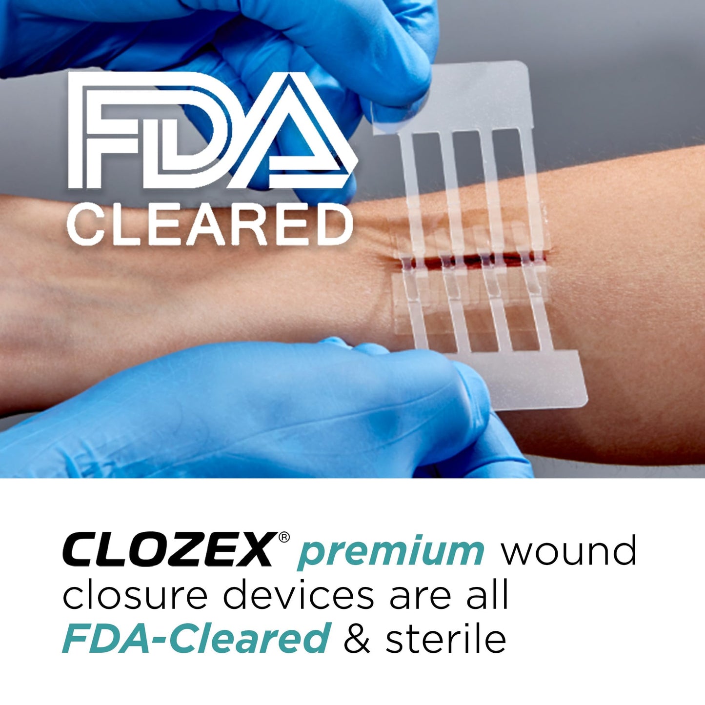 Clozex Pediatric Laceration Closures - Repair Wounds Without Stitches, FSA HSA Eligible Skin Closure Device for 3 Individual Wounds Or Combine for Total Length of 2 3/8 Inches