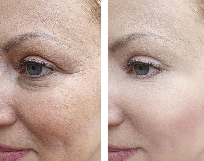 Vitality Precision Skin Phloretin C Serum