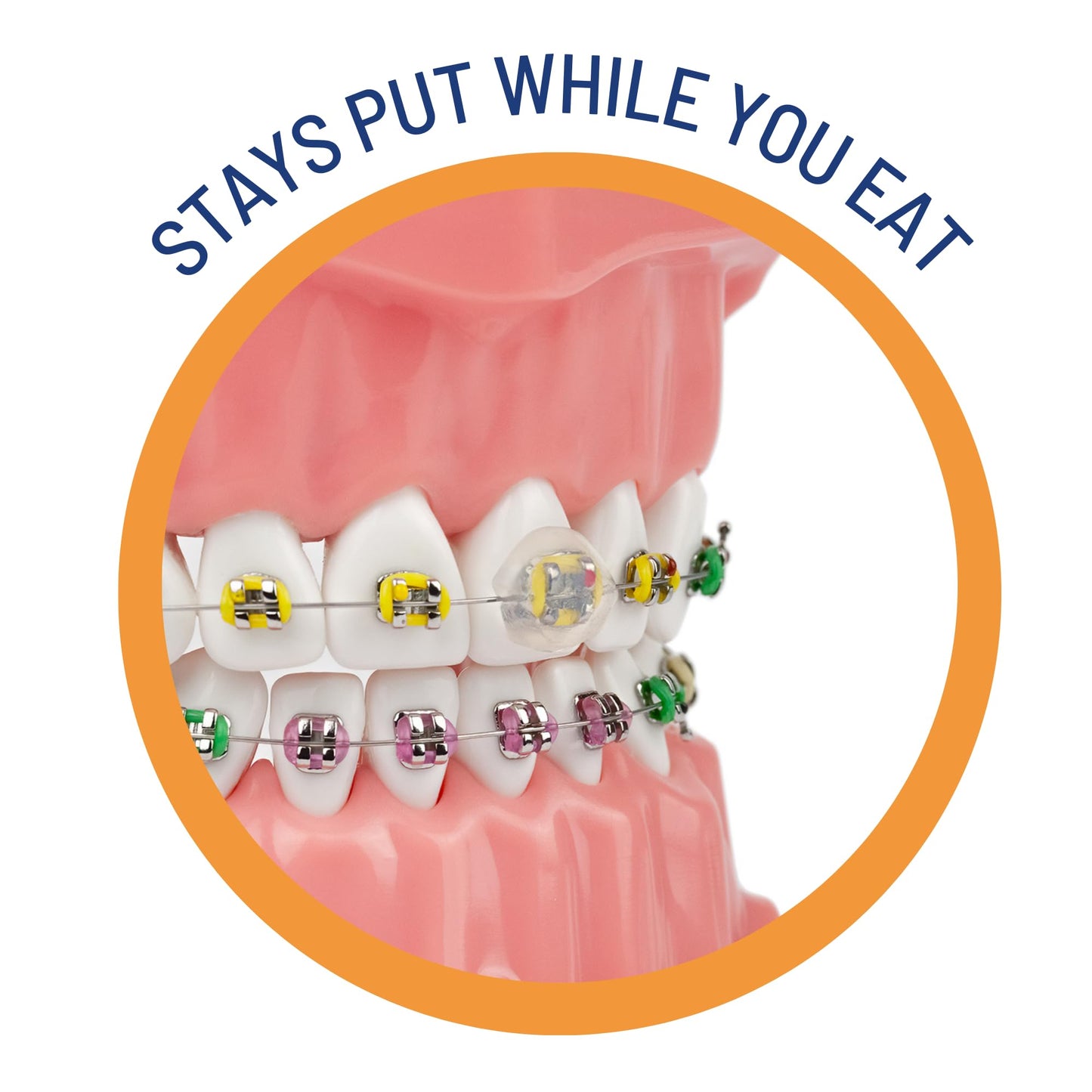 OrthoDots CLEAR – 24-Hour Protection | Sticks Better than Dental Wax | Moisture Activated Braces Wax Alternative for Pain Caused by Braces, Clear Aligner Trays, and Other Orthodontic Appliances