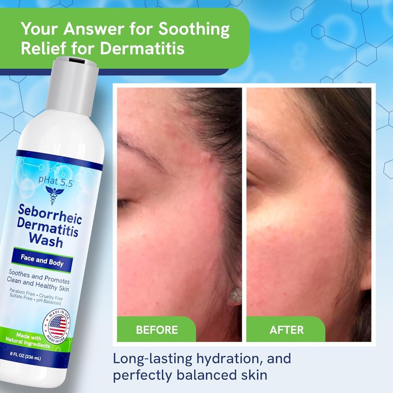 Gentle Face Wash for Seborrheic & Atopic Dermatitis | Natural Manuka Honey Cleanser for Sensitive Skin - 8oz, Hypoallergenic & Sulfate Free