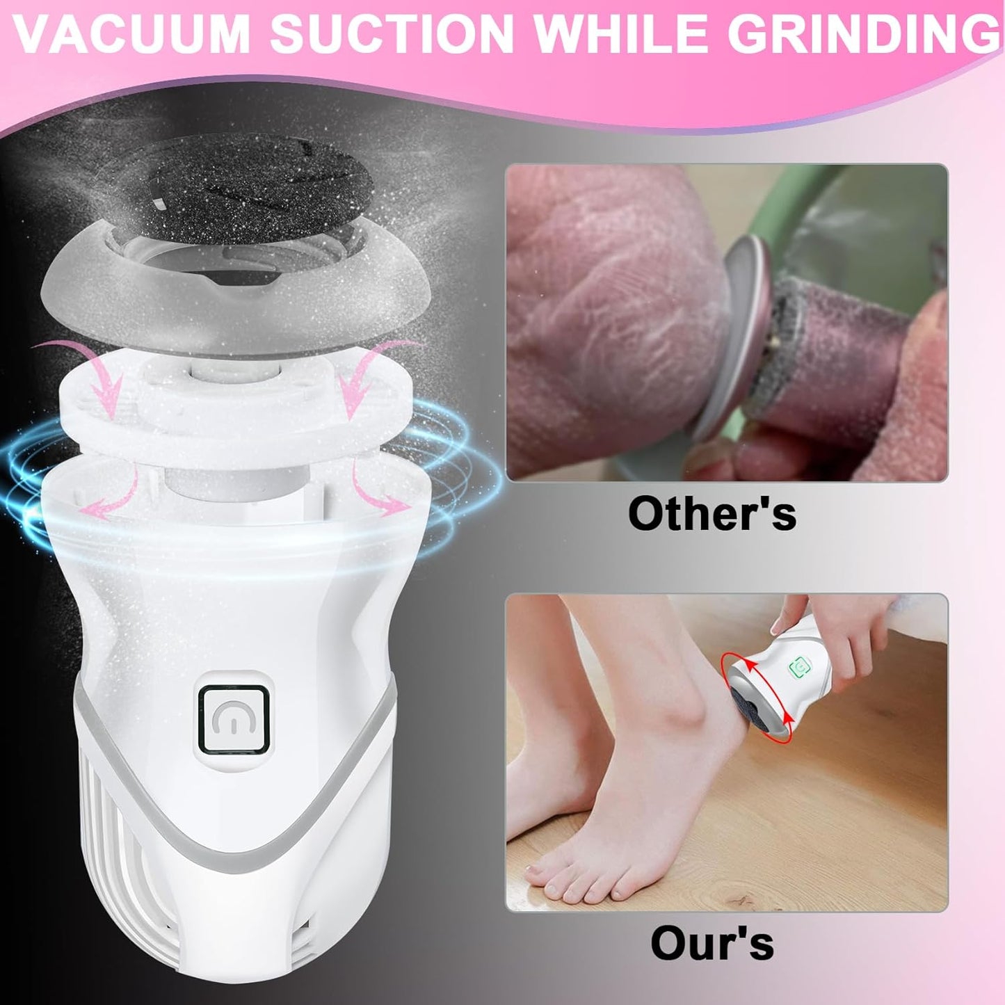 Electric Foot Callus Remover - Rechargeable Pedicure Tool with 2 Speeds & 6 Grinding Heads | Portable Foot File for Cracked Heels
