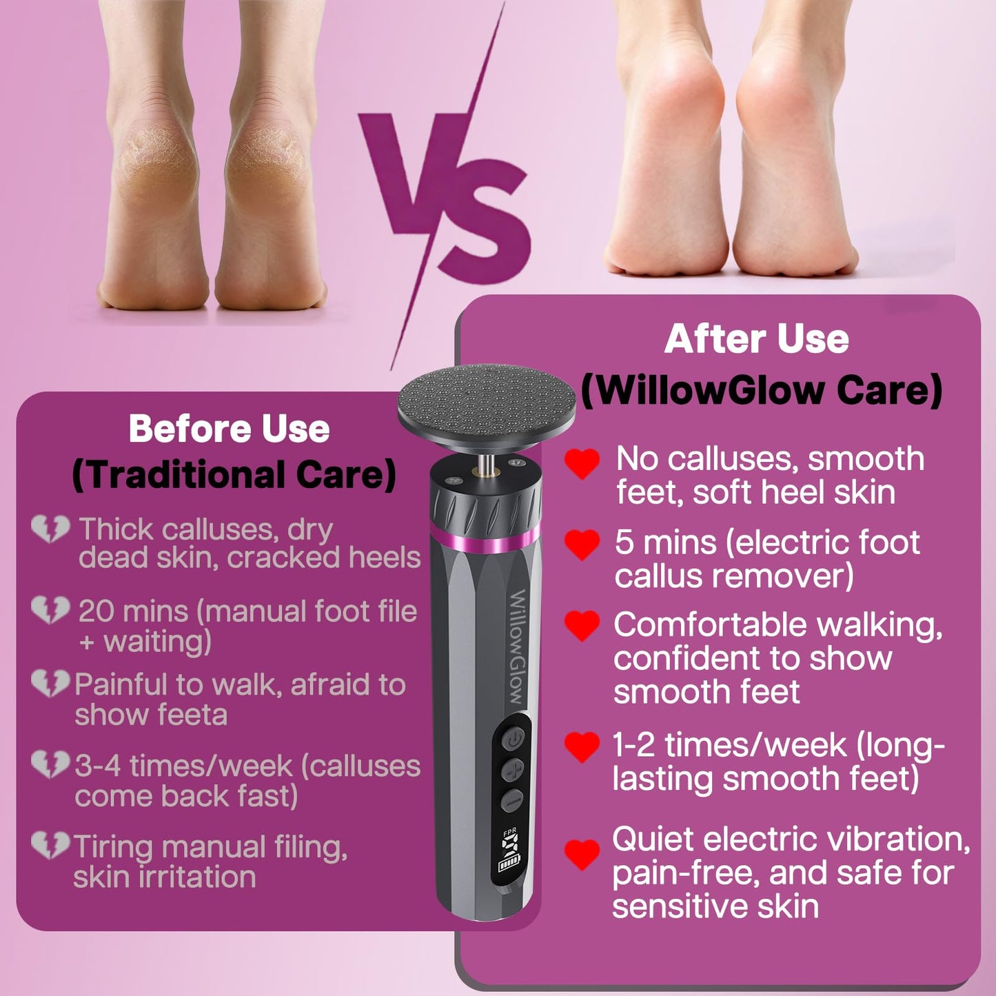 Professional Electric Foot Callus Remover, 9-Speed Cordless Foot File with Reusable Nano Glass Heads & Sandpaper for Dead Skin Removal and Smooth Feet
