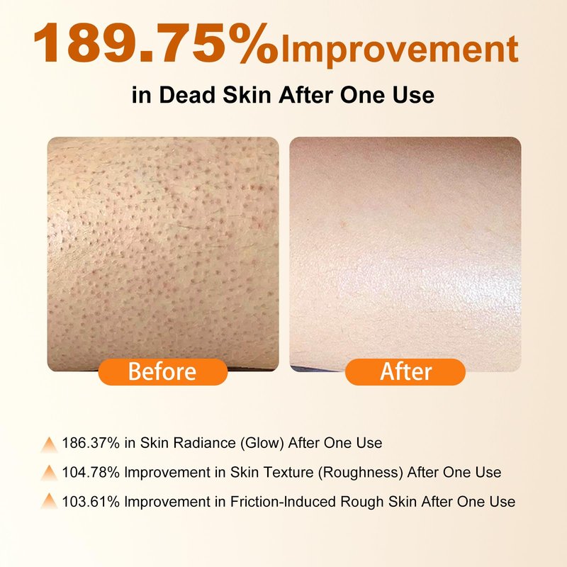 Body Keratin Care Kojic,Turmeric Spray Gentle Exfoliating,Renewing Serum Nurtures Your Delicate Skin Suitable for All Skin Types 200ml