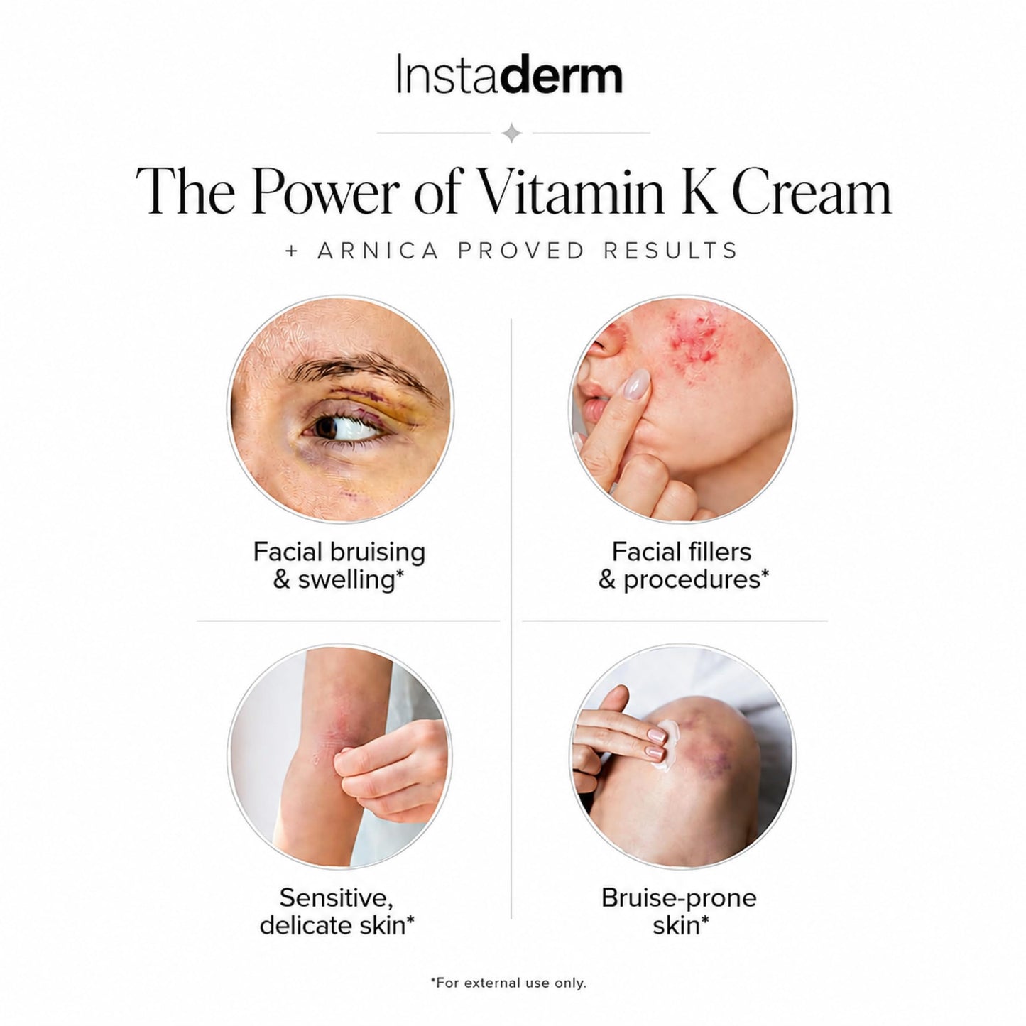Vitamin K Cream-Revitalizing Formula with Arnica for the Appearance of Brusing, Spider Veins, Broken Capillaries, Uneven Tone & Dark Spot – Under Eye Cream for the Look of Dark Circles & Puffiness