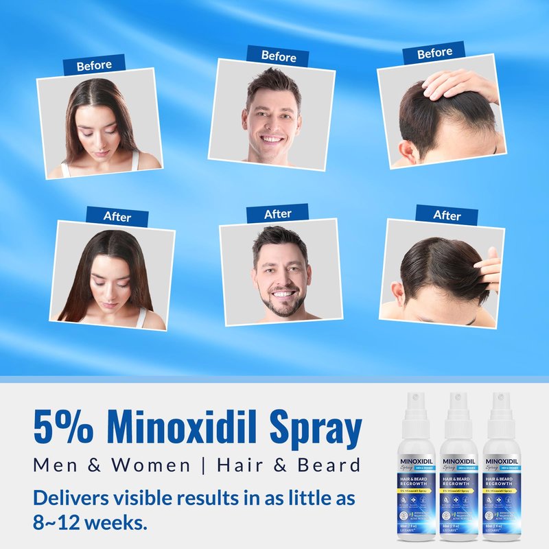 5% Minoxidil Spray 3PCS, Minoxidil for Men Hair and Beard, Minoxidil for Women Hair Growth, Minoxidil for Men Hair Growth.